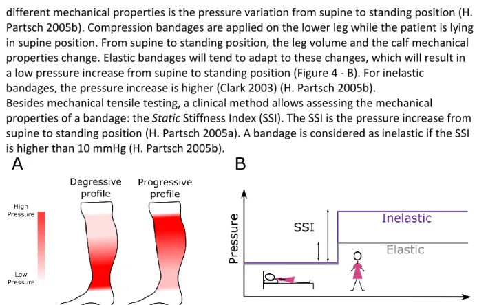 Figure 4: A- Illustration of a degressive and a progressive pressure profile; B- SSI for an elastic and an inelastic bandage 
