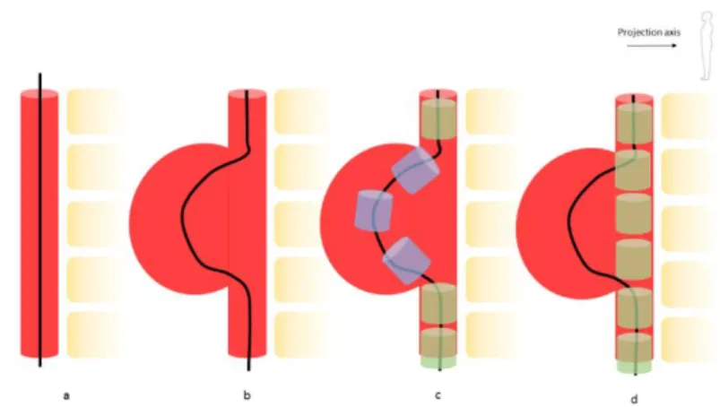 Figure 6 – Error in barycenter positioning due to a deformed centerline: 