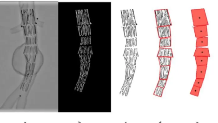 Figure 2 – Example of stent deployment in a 3D printed AAA replica: orig- orig-inal image (a), stent detection (b) and extraction (c), convex hull (d) and 2D 