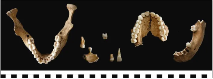 Figure 9. Échantillons de dents et d’os sélectionnés pour montrer la conservation différentielle des individus