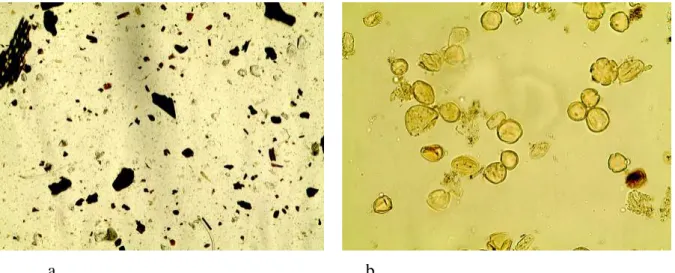 Fig.  1  :  a-  Q10-3.  Microscope  x  100.  Débris  de  lignine,  particules  argileuses,  cristaux  ;  b-  Q10-11