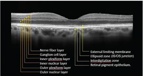 Figura 12 - OCT della retina 