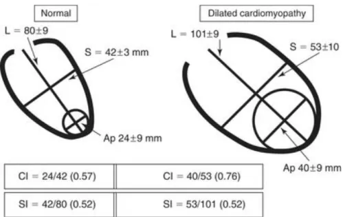 Figure 9 Geometric measures in normal and dilated cardiomyopathy. Sphericity index (SI)  is calculated as the short- to long-axis ratio (S/L), and conicity index (CI) as the apical to  short-axis ratio (Ap/S)