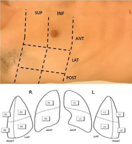 Figure 7 12-regions lung ultrasound dividing each hemithorax into an anterior, lateral and posterior lung  region, with a superior and inferior part