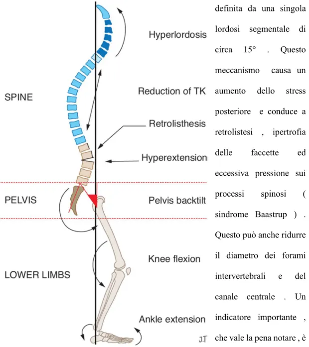 Figura  2.6  Meccanismo  di  compensazione  per  disequilibrio  anteriore:  iperlordosi  cervicale,  riduzione  della  cifosi  toracica,  retrolistesi  e  ipersestensione  lombare,    retroversione  pelvica,  flessione  delle  ginocchia  e  caviglie