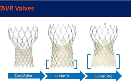 Figura 13: Evoluzione delle valvole autoespandibili Medtronic. 