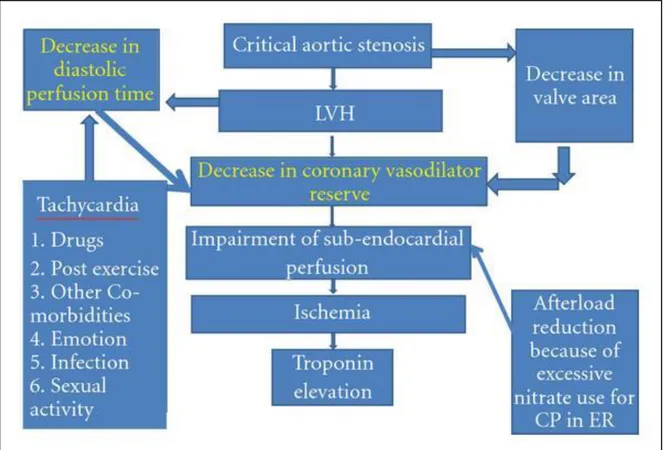 Figura 3: Fisiopatologia della stenosi aortica. 
