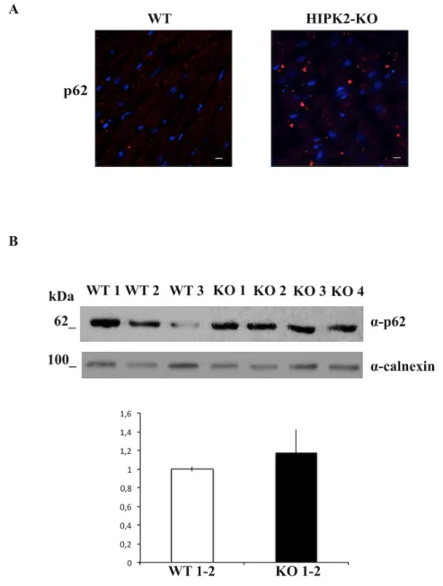 Figure  10.  Evaluation  of  p62/SQSTM1  in  HIPK2-KO  mice.  A  Representative immunofluorescente images of heart cryosections of  WT  and  HIPK2-KO  mice  at  18  months  of  age  stained  with  p62/SQSTM1  antibody