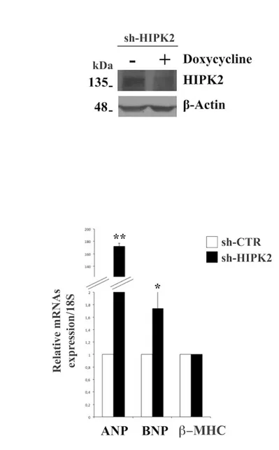 Figure  12.  HIPK2  silencing  promotes  expression  of  cardiac  failure markers in H9C2 cells