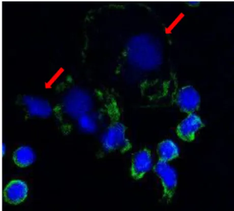 Figure 4. Staining of isolated cells with Hoechst/Draq5 mix (blue) and CD45  antibody (green); red arrows indicate CTCs (63X objective)