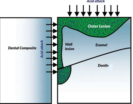 Figure  11.  Schematic  representation  of  injuries  related  to  the  secondary  caries lesions and external wall