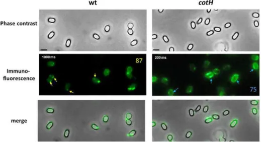 Figure  6:  Immuno-fluorescence  microscopy  of  wild  type  and  mutant  spores  adsorbed  with  mRFP