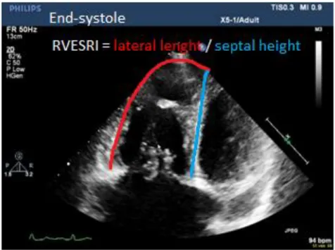 Figure 1. Representative echocardiographic images of the assessment of right ventricular  systolic  function:  right  ventricular  end-systolic  area  for  the  assessment  of  RVESRI