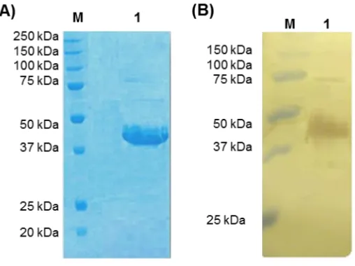 Figure 2.5: 15% SDS-PAGE (A) and western blot analysis (B) of ProSys pooled fractions