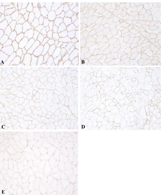 Figure 2. Changes produced in immunohistochemical labelling for dystrophin in cross-
