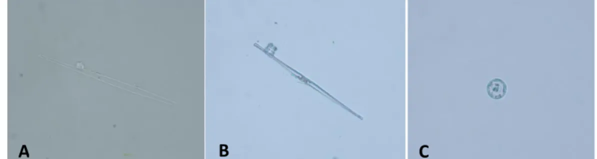 Figure 2.  The most common diatoms identified in animals of the Group A. A-B:  Cylindrotheca fusiformis; C: Cyclotella sp