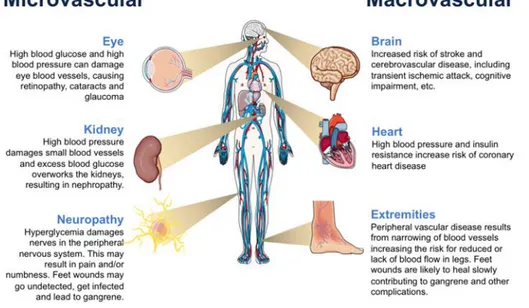 Figure 5.  Major microvascular and macrovascular complications associated with  diabetes mellitus