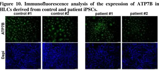 Figure  10.  Immunofluorescence  analysis  of  the  expression  of  ATP7B  in  HLCs derived from control and patient iPSCs