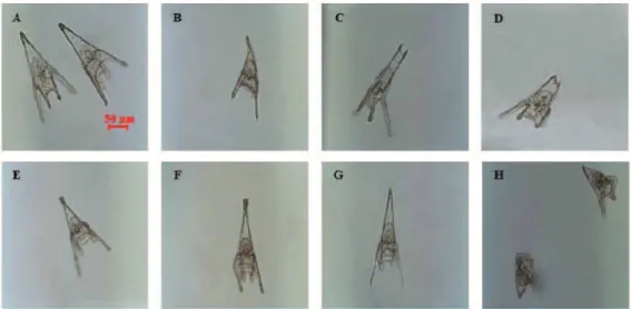 Figure 1.13. Examples of malformations of P. lividus plutei affecting: the apex (B) with spicules either  parallel or disjoined (C, D) or crossed at the tip (E); the arms longer and broader or crooked and  asymmetrical (F) or completely degenerated (G); th