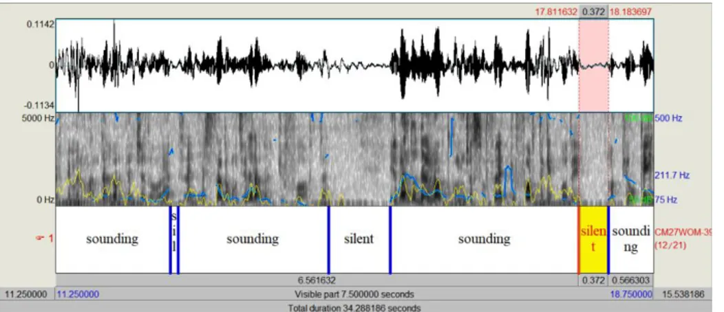 Figure 2.2 Example of speech-silence segmentation of a Tale recording. 