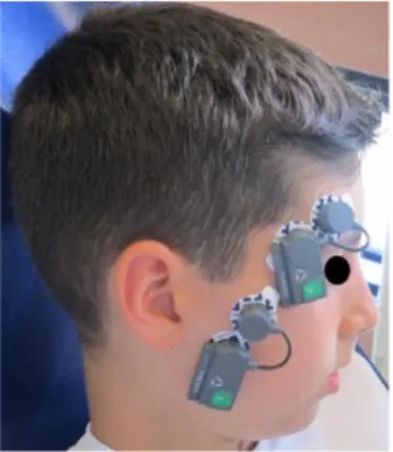 Figure 1.1. A patient with electrodes in place.