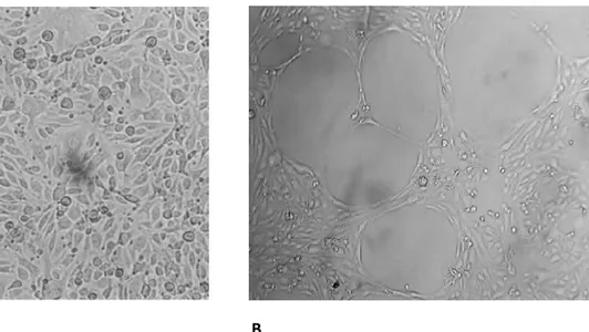 Figure  9.  bEND5  cells  form  capillary-like  networks  in  vitro:  A)  bEND5  plated  on  plastic  dish,  at 