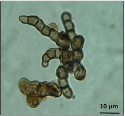 Figure 1.3 Cryomyces antarcticus at light microscope. 