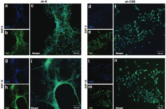 Figure 2 Immunofluorescence staining for neuronal marker Tuj1 in sh-K (a–c and g–i) and sh-CSB (d–f and l–n) cells after differentiation at days 9 and 12