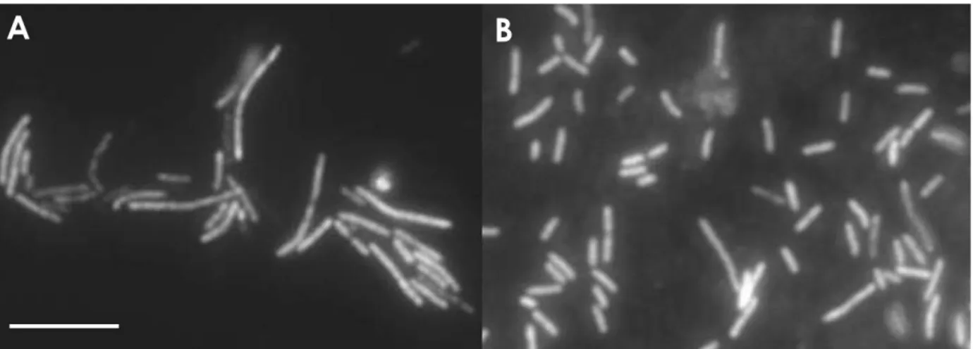 Figure 4 – FISH analysis of Coprothermobacter proteolyticus (DSMZ 5265) using CTH485 probe (a), and  of thermophilic anaerobic sludge (b) using the probe  together with helper CTH439