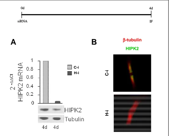 Figure 12. HIPK2 levels post RNAi 