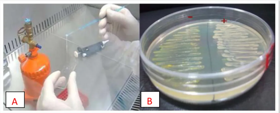 Figure 9: A: Oxidase production test; B: Potato rotting test. 
