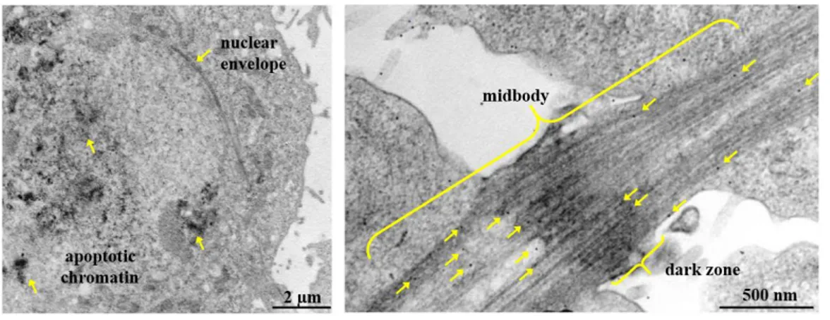 Figure 12. TEM, localization of endogenous histone H2B-S14P in telophase. 