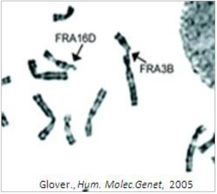 Figure  2Examples  of  common  fragile  sites.  Human  G-