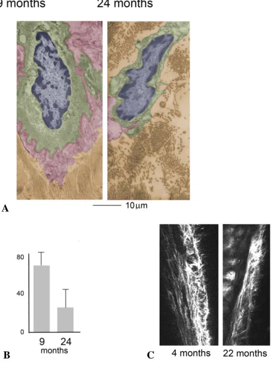 Figure 14: (A) Transmission electron microscopy of mesenteric lymphatic vessels isolated 