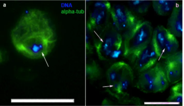 Figure  5  ms(2)Z5584  homozygous  mutant defects. DNA (DAPI staining)  in blue, meiotic spindle (alpha-tubulin  staining)  in  green