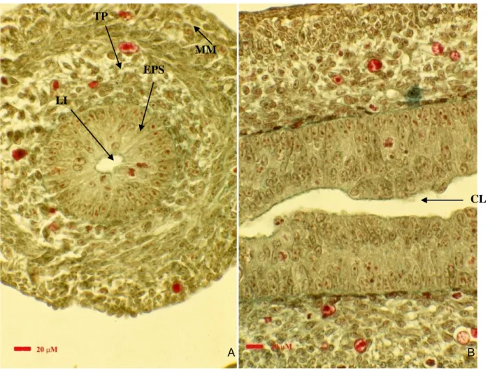 FIG. 1    A =sez trasversale :LI= Lume Intestinale, EPS = Epitelio Pseudo-Stratificato, TP = Tonaca Propria, 