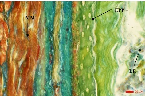 FIG. 11  Esofago MM = Muscularis Mucosae, EPP = Epitelio Pavimentoso Pluristratificato, LE = Lume  Esofageo.(col