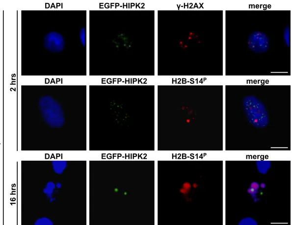 Figure 9. Localization of EGFP-HIPK2, γ-H2Ax and H2B-S14P in Irradiated Cell. 