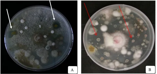 Fig 18. The arrows indicate the bacterial colonies present in the water suspension of ECOS 