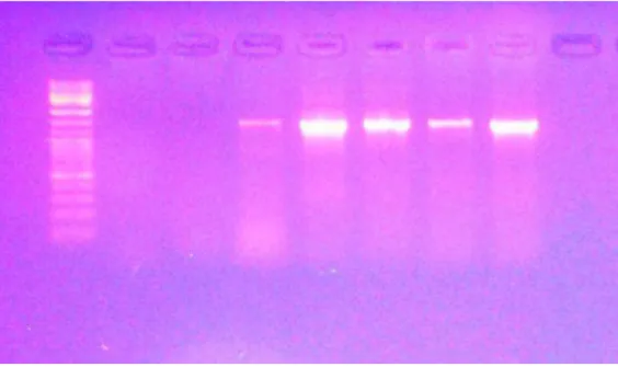 Fig. 21. Corsa su gel di agarosio del prodotto PCR da DNA di Brenneria nigrigluens.  CTTANACATGCAGTCGAACGATGATTATCTAGCTTGCTAGATATGATTAGTGGCGGAG GGTGAGTAACATTTAGGAATCTGCCTAGTAGTGGGGGATAGCTCGGGGAAACTCGAAT TAATACCGCATACGACCTACGGGTGAAAGGGGGCGCAAGCTCTTGCTATTAGA