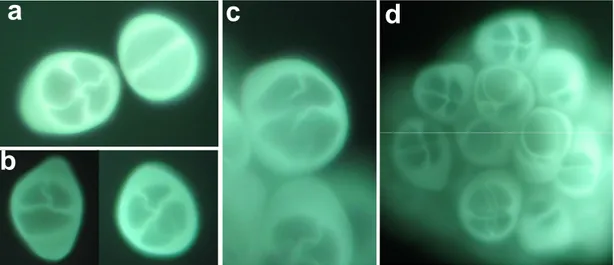 Fig.  13   –  Anomalie  meiotiche  riscontrate  in  aglio  della  cultivar  Rosso  di  Sulmona