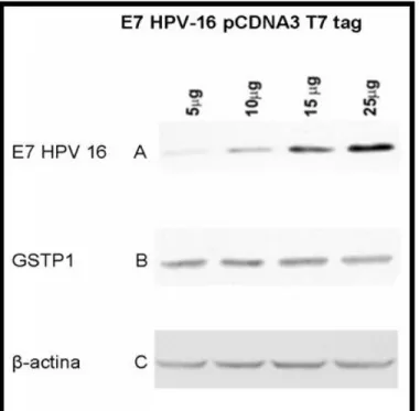Fig. 11.  Analisi dei livelli proteici di GSTP1 in relazione a livelli  di espressione ectopica crescenti di E7 HPV-16