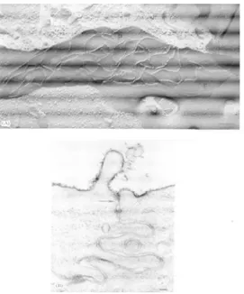 Fig 5 Structure of tight junctions. A) electron microscopy image of tight junctions after freeze-fracture