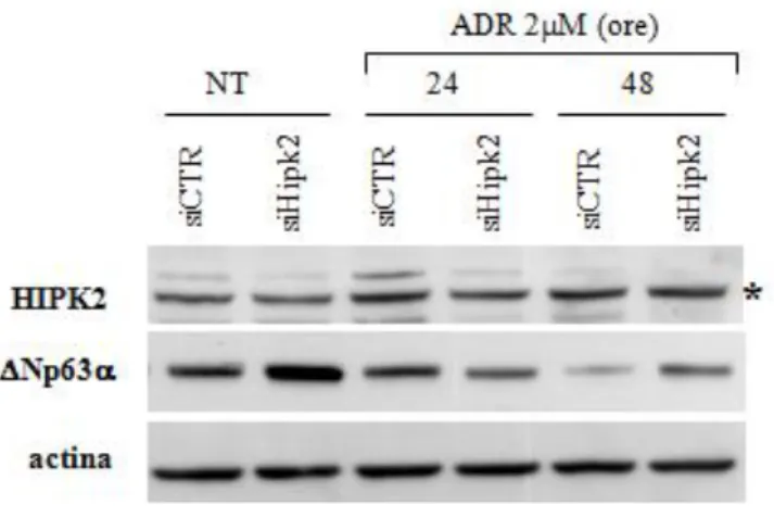 Figura 11 – L’interferenza di HIPK2 mediante siRNA recupera la degradazione di DeltaNp63   in  risposta all’Adriamicina