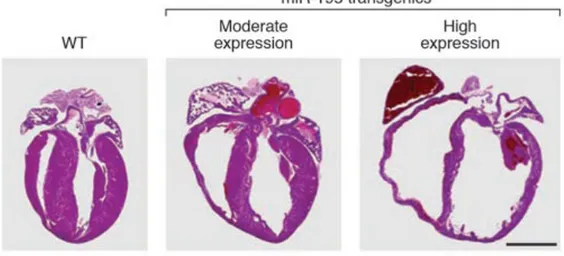 Figure 10 Induction of cardiac hypertrophy and heart failure by miR-195. H&amp;E sections of 2- 2-week-old  wild-type  and  transgenic  mice  expressing  miR-195  under  control  of  the  áMHC  promoter