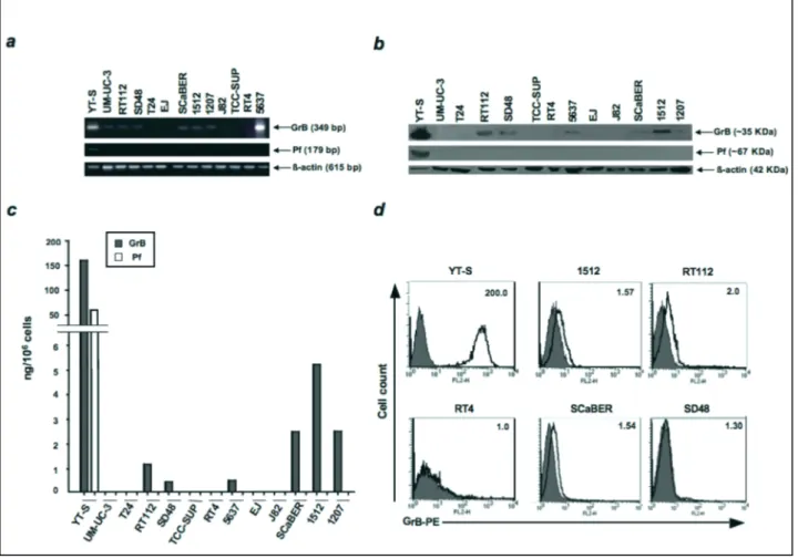 FIG. 12 Analisi dell’espressione di GrB in linee cellulari tumorali di vescica. (a) mRNA di GrB e Pf determinato mediante RT-PCR, (b) espressione 