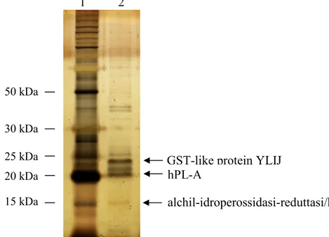 Figura  12  -    12.5%  SDS-PAGE  e  rivelazione  delle  proteine  con  colorazione  AgNO 3 