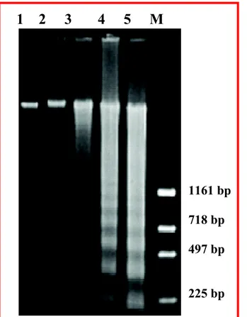 Fig. 4. Frammentazione del DNA. Le cellule PaCa-44 sono state trattate per un unico tempo di incubazione di 48h con diverse concentrazioni di DHA (50, 100, 150, 200 µM) e sottoposte ad estrazione di DNA come descritto in Materiali e Metodi
