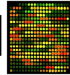 Figura 1.4: Immagini relative a due esperimenti microarray. Quella di si- si-nistra ` e relativa a un microarray a singolo canale e rappresenta dei livelli di espressione genica assoluti, quella di desta ` e relativa a un microarray a doppio canale e rappr
