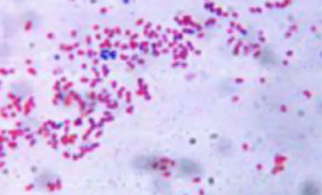 Figure 1. Gram stain of A. baumannii cells: notice that most cells appear Gram-negative  (red)  while  few  ones  show  the  typical  feature  of  retaining  the  crystal  violet  dye  appearing as Gram-positive (blue) (candidate’s picture)